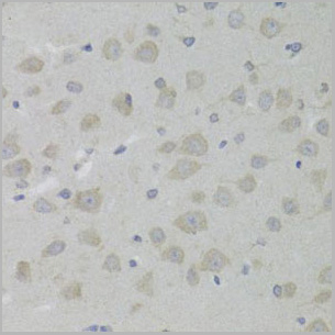 product-image-AAA28095_IHC4.jpg