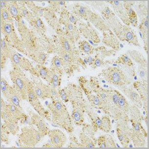 product-image-AAA28095_IHC5.jpg