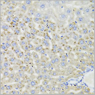 product-image-AAA28095_IHC6.jpg