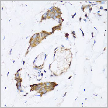 product-image-AAA28121_IHC3.jpg