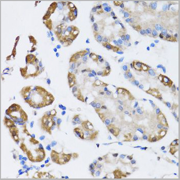 product-image-AAA28121_IHC4.jpg