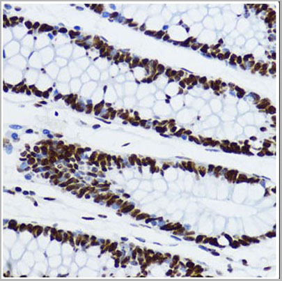 product-image-AAA28124_IHC4.jpg