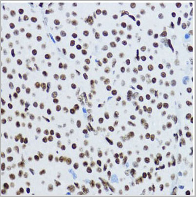product-image-AAA28124_IHC5.jpg