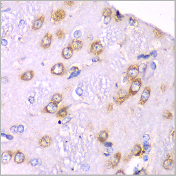 product-image-AAA28136_IHC3.jpg