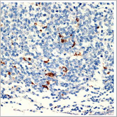 product-image-AAA28140_IHC4.jpg