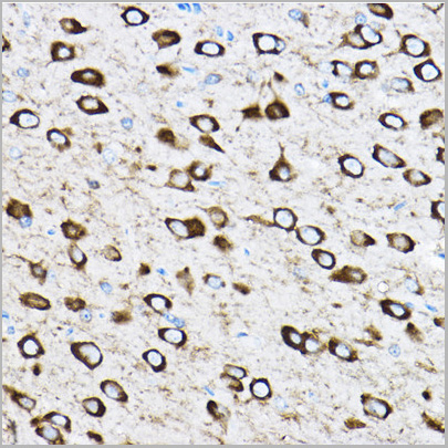 product-image-AAA28147_IHC2.jpg