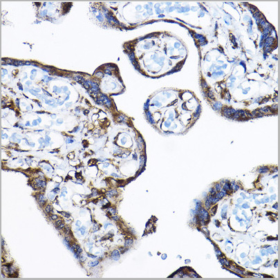 product-image-AAA28147_IHC3.jpg