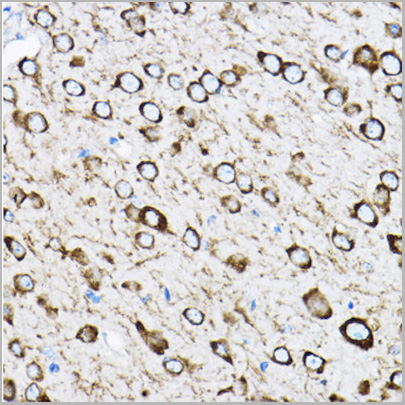 product-image-AAA28147_IHC4.jpg