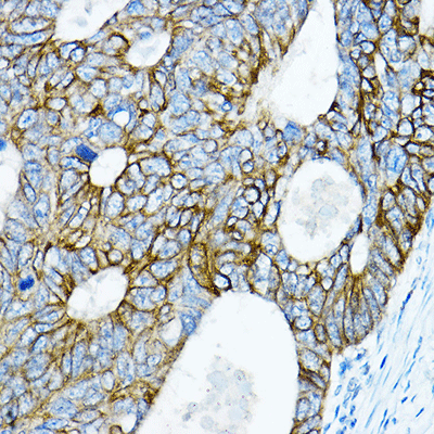 product-image-AAA28156_IHC3.jpg