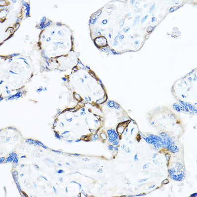 product-image-AAA28156_IHC4.jpg