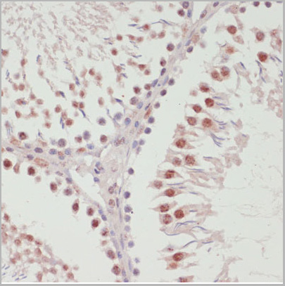 product-image-AAA28160_IHC2.jpg