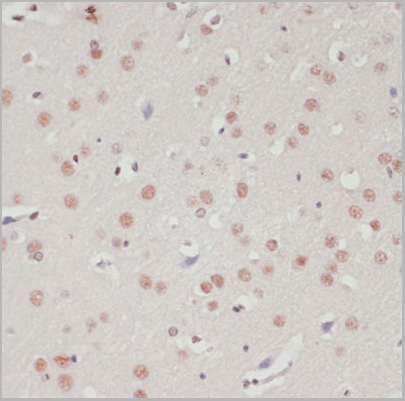 product-image-AAA28160_IHC3.jpg