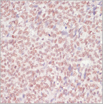 product-image-AAA28160_IHC7.jpg