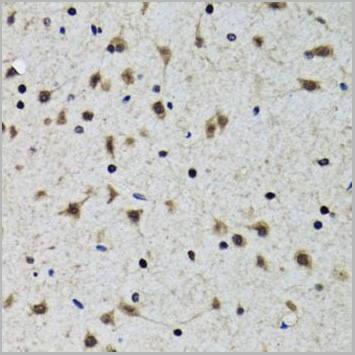 product-image-AAA28167_IHC2.jpg