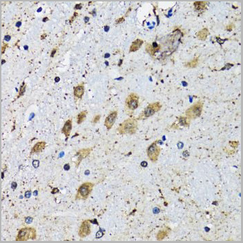product-image-AAA28167_IHC5.jpg