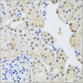 product-image-AAA28171_IHC2.jpg