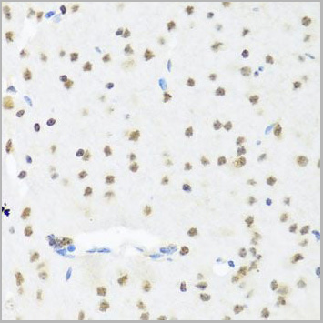 product-image-AAA28171_IHC3.jpg