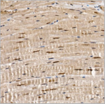product-image-AAA28190_IHC6.jpg