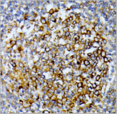 product-image-AAA28198_IHC2.jpg
