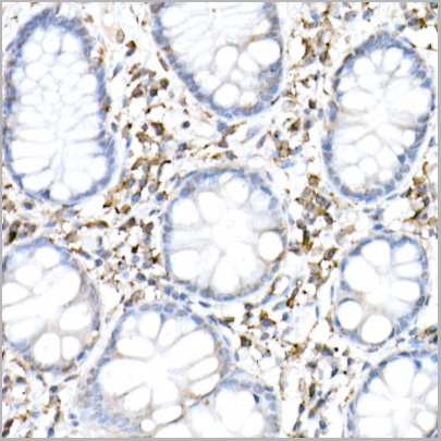 product-image-AAA28207_IHC5.jpg