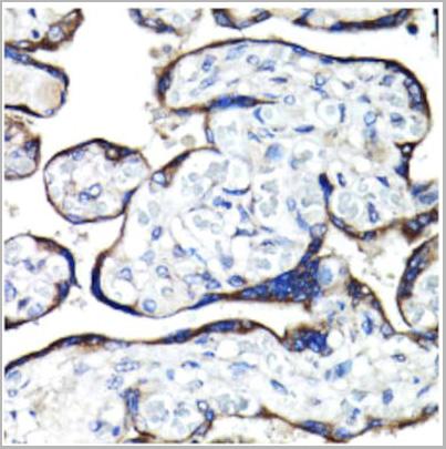 product-image-AAA28214_IHC2.jpg