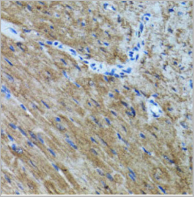 product-image-AAA28214_IHC4.jpg