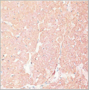 product-image-AAA28220_IHC3.jpg