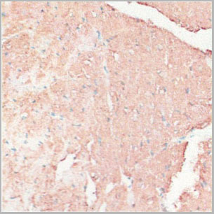 product-image-AAA28220_IHC5.jpg