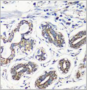 product-image-AAA28228_IHC4.jpg