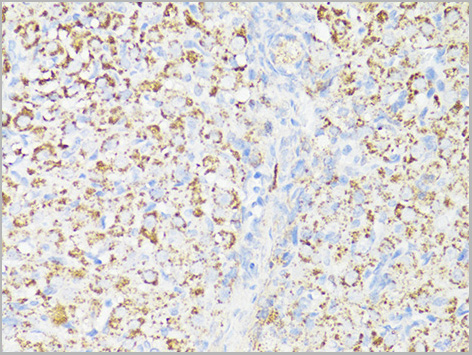 product-image-AAA28241_IHC2.jpg