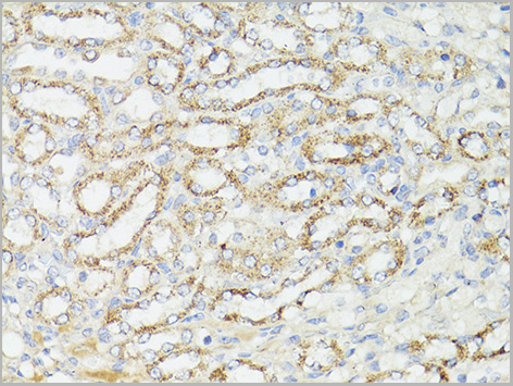 product-image-AAA28241_IHC4.jpg