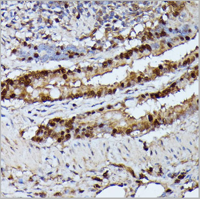 product-image-AAA28246_IHC3.jpg