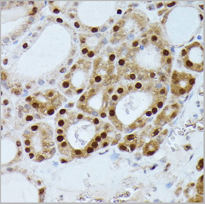 product-image-AAA28246_IHC4.jpg