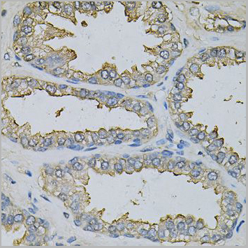 product-image-AAA28262_IHC2.jpg