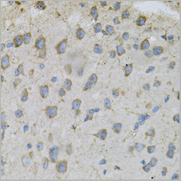 product-image-AAA28262_IHC3.jpg