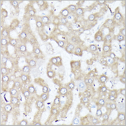 product-image-AAA28262_IHC7.jpg