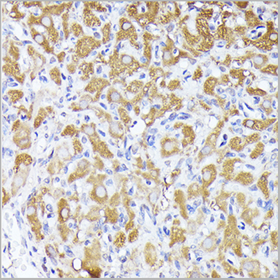 product-image-AAA28262_IHC8.jpg
