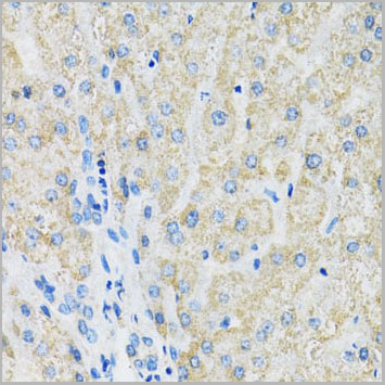 product-image-AAA28277_IHC.jpg