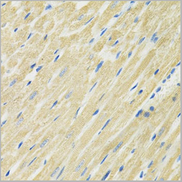 product-image-AAA28277_IHC2.jpg