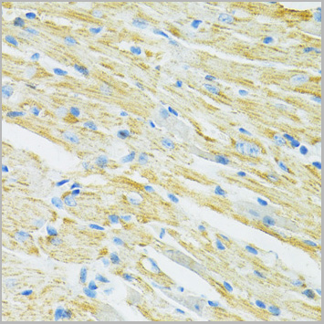 product-image-AAA28277_IHC3.jpg