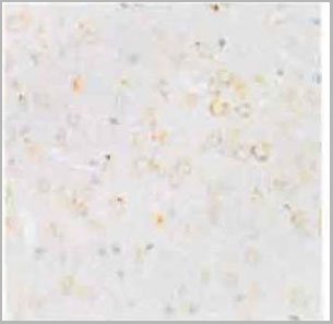 product-image-AAA28280_IHC3.jpg