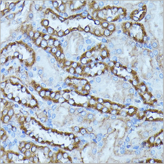 product-image-AAA28295_IHC2.jpg