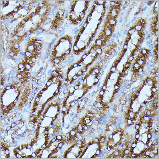 product-image-AAA28295_IHC6.jpg