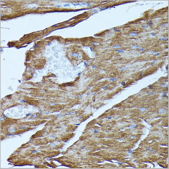 product-image-AAA28295_IHC7.jpg