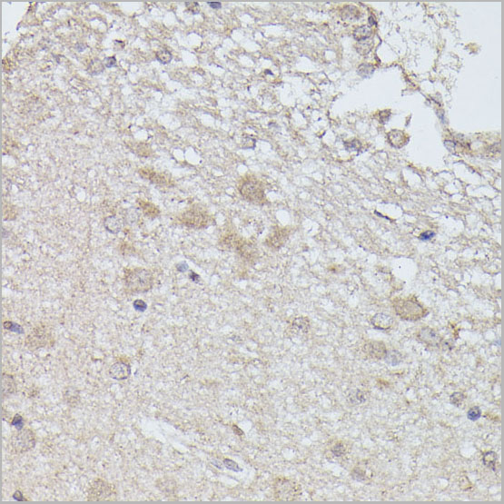 product-image-AAA28319_IHC2.jpg