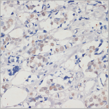 product-image-AAA28335_IHC4.jpg