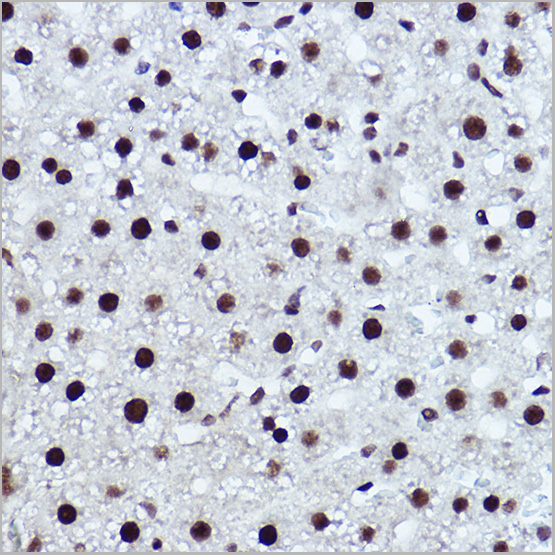 product-image-AAA28372_IHC4.jpg