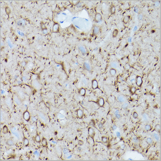 product-image-AAA28393_IHC2.jpg