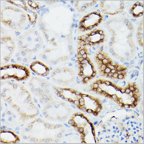product-image-AAA28393_IHC3.jpg