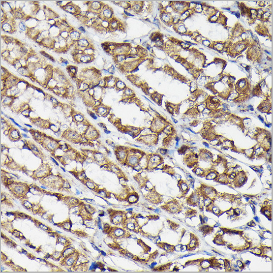 product-image-AAA28395_IHC3.jpg